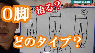 [O脚のタイプ]　O脚にも色々ある。治る？治りにくい？　　　京田辺市松井山手の「京田辺たかはし整体院」整体、産後骨盤矯正、O脚矯正