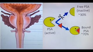 Free vs Bound PSA EXPLAINED (Prostate Specific Antigen)