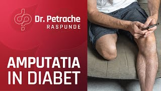 AMPUTATIA IN DIABETUL ZAHARAT