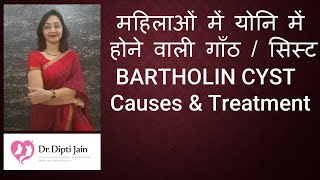 महिलाओं में योनि में होने वाली गाँठ / सिस्ट  BARTHOLIN CYST - CAUSES \u0026 TREATMENT/ Dr Dipti Ahmedabad