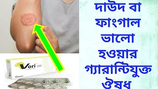 চর্মরোগ বা দাউদ নিয়ে সমস্যা আছেন? চর্মরোগ ভালো করার মহাঔষধ Vori সেবন করন!