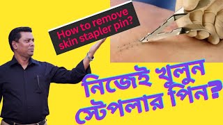 How to remove skin stapler pin| Skin stapler pin remover| skin stapler use|কিভাবে পিন খুলবেন?