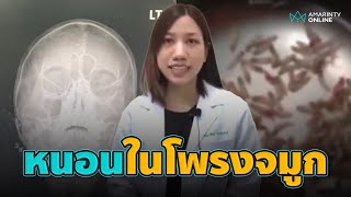 สุดสยอง! กองทัพหนอนนับร้อยในโพรงจมูก | อมรินทร์อัปเดต