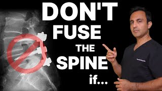 When you don't NEED a spinal fusion