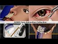 ASMR Care Animation! Stye Treatment, Eyelid Sebum Extrusion, Giant Snot Removal, Scalp Scaling