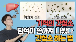 담석이 쏟아져 나온 기적의 간청소 하는 법, 경험담 들려드립니다. GB flushing, Liver and gallbladder flush, 안드레아스