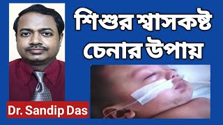 শিশুদের শ্বাসকষ্ট চেনার উপায় | How to spot breathing difficulty in children | Dr. Sandip Das