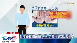 富貴手擦藥沒效？醫師看傻「這治香港腳的」