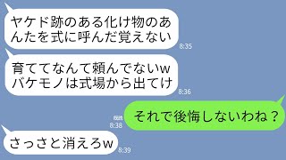 【LINE】25年間大切に育てた夫の連れ子の結婚式で娘「ヤケド跡の醜いお前を母親と思ったことないwバケモノは帰れｗ」→お望み通り帰宅すると大絶叫の娘から鬼電がwww