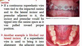 The First Stage of Comprehensive Treatment - Part1