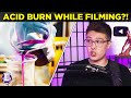 NileRed Burned Himself with Acid While Recording a Video