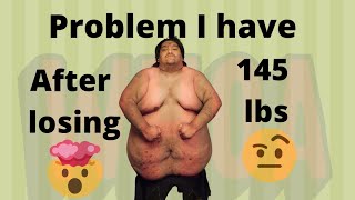 DOWN 145 LBS AND NOTHING TO SHOW FOR IT RANT!!!! weight loss Obese morbidly obese