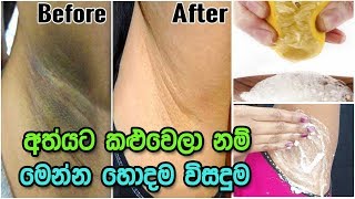 අත්යට කළුවෙලා නම් දැන්මම ඔයත් මේවා ආලේප කරන්න | Whiten Dark Underarms Instantly