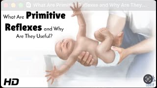 Primitive Reflexes: What & Why