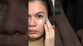 Day 4 | 30 day Consistent Skincare Challenge | At home Microneedling | Acne Scars Treatment #youtube