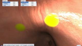 EndoSim Upper GI: Photo