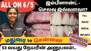 All on 6/5 இம்பிளாண்ட் + முழு fixed பல்செட்! Cost of Full mouth dental implants, Chennai, India.