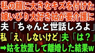 【スカッとする話】私の顔に大きなキズを付けた嫁いびり大好き姑が要介護に。夫「ちゃんと世話しろよ」私「え、しないけど」夫「は？」➡︎姑を放置して離婚した結果w