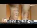 검찰 관악산 집단폭행 가해 학생 9명 모두 기소 연합뉴스tv yonhapnewstv