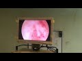 Dr. Vaishali Sharma: Laparoscopic surgery