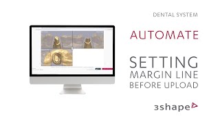 3Shape Automate –  Setting the margin before import (Italian)