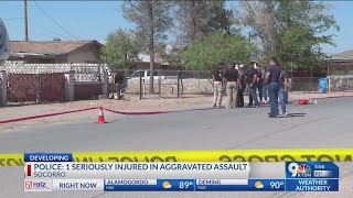 Socorro Police: 1 seriously injured in aggravated assault