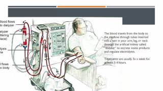 MHS HSC Biology - Comparing Renal Dialysis to Kidney Function