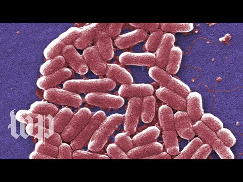 Can you get e coli from kissing?