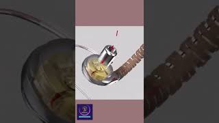 Heartware Ventricular Assist Device #shorts #animation