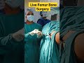 Live Femur Bone Surgery | #femur #bonefracture #bonepain #orthopedicdoctor #mbbs #medicalstudents |