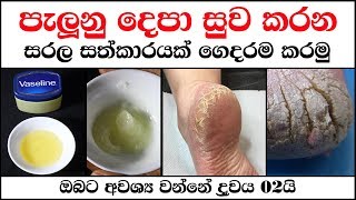 පැලුනු දෙපා සුව කරන සරල සත්කාරයක්  - cracked heels home remedies