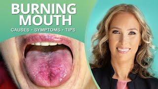 What Is Burning Mouth Syndrome, Causes, Symptoms \u0026 Tips | Dr. J9 Live