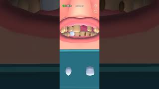 Master Doctor 3D Game Level 15 #masterdoctor3d #level15