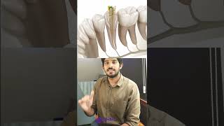 WHAT IS ROOT CANAL??||||റൂട്ട് കനാല് എന്നത് ഞരമ്പ് മുറിക്കൽ ആണോ??ROOTCANAL EXPLAINED UNDER 1 MINUTE