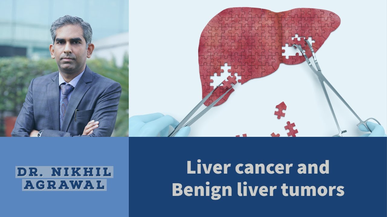 Liver Cancer And Tumors Symptoms Diagnosis And Treatment Best