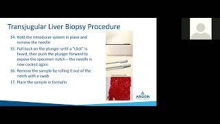 Transjugular Liver Biopsy Procedure and Argon Medical's TLAB Tricks \u0026 Tips