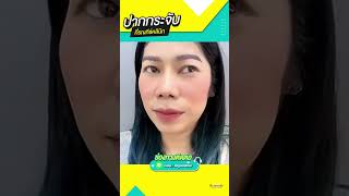 ปากกระจับกระใจ สวยจุ๊บ! | รณภีร์คลินิก