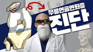 무릎연골연화증 자가진단법! (무릎 통증 필독)