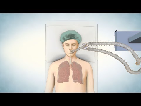 Lung Transplant Process Lung Transplant Process