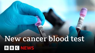 Blood test for more than 50 cancers 'shows promise' in study - BBC News