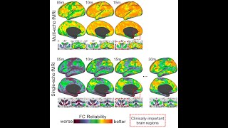 Multi-Echo Sequences and Resting-State fMRI