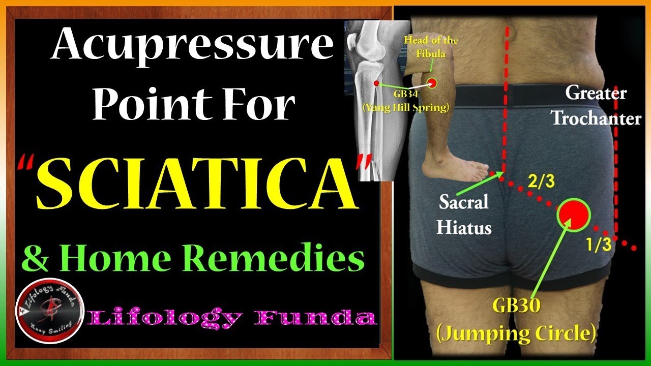 Sciatica - Acupressure Point & Home Remedy | साइटिका – एक्यूप्रेशर ...