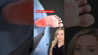 Doctor explains: plantar fasciitis surgery