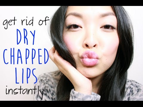HOW TO: Get Rid of Dry, Chapped Lips INSTANTLY! HOW TO: Get Rid of Dry, Chapped Lips INSTANTLY!