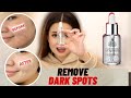 How to get rid of dark spots on face ft Kiehls clearly corrective dark spot solution