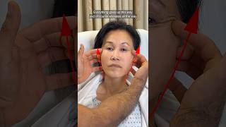 60-Year-Old Facial Rejuvenation Pre-Op Plan