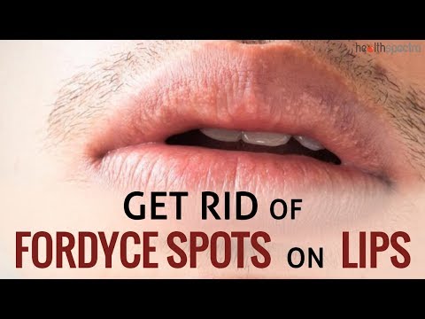 Why do I have pimple like bumps on my lips?