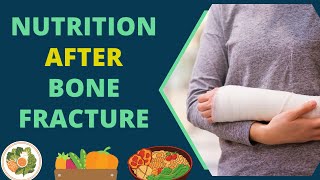 Diet for Bone Fracture Recovery