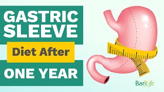 1 Year After Gastric Sleeve:  What your diet should look like