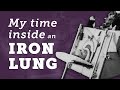 Overcoming a Lonely Childhood | My Time Inside an Iron Lung